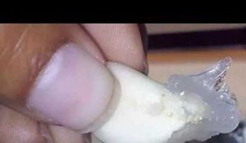 Vick vaporub y un diente de ajo para tratar enfermedades: El mejor truco del MUNDO 