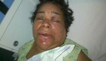 Roban en casa de constitucionalista y golpean a su esposa