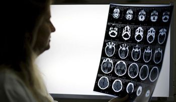 ?omer cerebros humanos protegió a una tribu de las enfermedades cerebrales