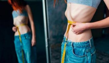 La anorexia es una enfermedad potencialmente mortal; tiene un origen metabólico y psiquiátrico