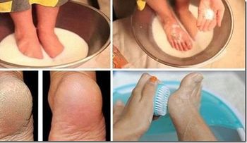 No gaste tu dinero en pedicura: Usa dos ingredientes de tu cocina para que se vean increíbles!..