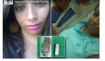 A una brasileña (Jucilene Marinho) le reconstruyen exitosamente la vagina con piel de pescado 