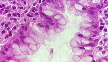 Una superbacteria mortífera que se propaga amenaza acabar el mundo 