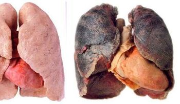 7 señales iniciales y síntomas del cáncer de pulmón, y como prevenirlo 