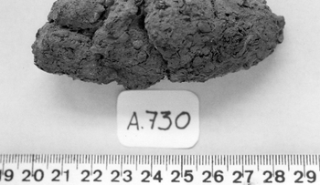 Analizan excrementos de una sociedad antigua para entender la causa de la diabetes