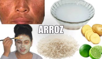 Mascarilla de arroz que quitan manchas y blanquean la piel de mujeres y hombres