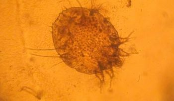 La sarna o escabiosis es una enfermedad de la piel que afecta a cualquier tipo de persona, rico o pobre