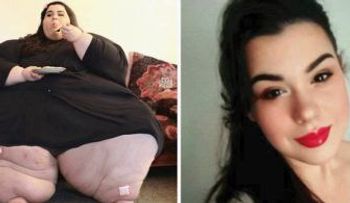 Esta mujer pesaba 298 kilos, perdió 50 kg y su cambio te dejará impactado