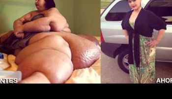 La mujer más gorda del mundo logró un cambio increíble 
