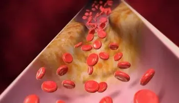 La acumulación de placas en las arterias (aterosclerosis) provoca un envejecimiento más rápido