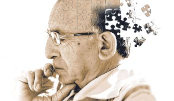Una terapia logra reducir una proteína vinculada al alzheimer