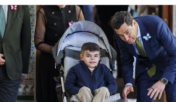 La Junta cubrirá tratamiento de la Epidermólisis bullosa