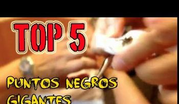 Tenía más de 10 años con un punto negro GIGANTE en la oreja y se imaginó lo que saldría de AHI