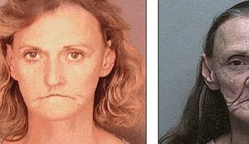 El rostro de la droga: antes y después de la adicción