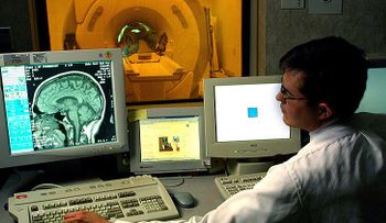 ¿Una cura para el Alzheimer? Preparan la primera vacuna que detiene su progreso
