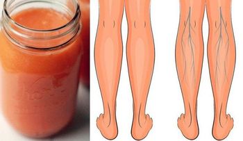 ¿Mala circulación y pies hinchados? Este batido ayudó mi abuelita de tanto lidiar con ello