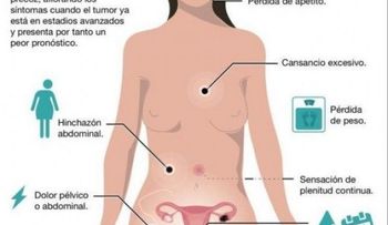 Descubren papel de dos genes en áncer de ovario más agresivo