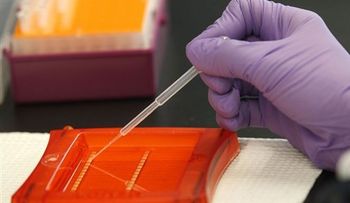 EEUU estudia aprobar fármaco contra el colesterol 