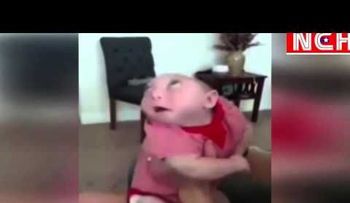 Conoce el bebé que nació sin parte del cráneo y el cerebro (VIDEO)