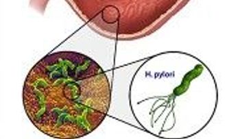 Médico japonés revela el mejor remedio para eliminar el Helicobacter Pylori, con 1 brócoli, sal marina y agua