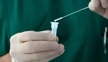 OMS: reducir las pruebas Covid complica seguimiento de pandemia