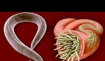 10 trucos para saber si tiene amebas o parásitos en el cuerpo y cómo eliminarlos 