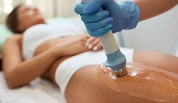 5 teorías sobre la celulitis que no son reales