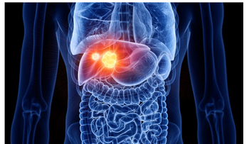 Rafael Bañares advierte: alcohol y grasa elevan riesgo hepático