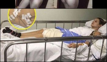 Sábado Gigante: Confinada en una silla de ruedas y dice: Estoy pagando por mi vanidad 