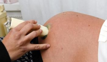 Antidepresivos en el embarazo, posible causa de niños hiperactivos