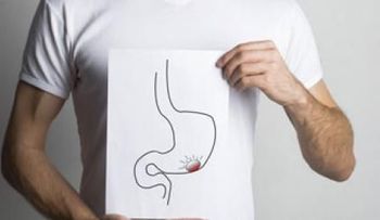 Tumores benignos de cáncer de estómago