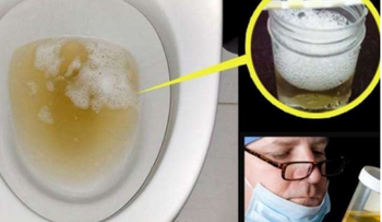 URGENTE a un médico si orina más espumoso de lo normal