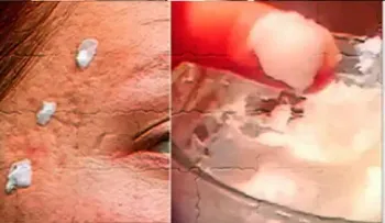 Mezcla de bicarbonato para tener un rostro joven y sin arrugas