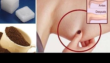 La flacidez de los brazos, el  mejor remedio para eliminarla 