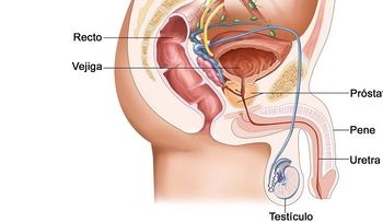 El cáncer de pene, una enfermedad poco conocida; tratamiento