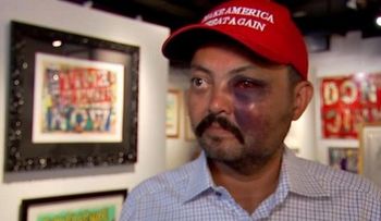 Un hombre recibe una brutal golpiza por usar gorra de Trump; dominicanos condenan agresión 