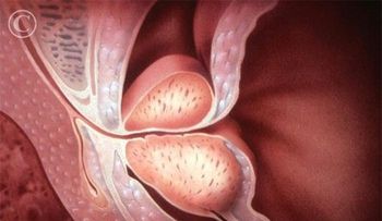 Médicos españoles localizan gen favorece resistencia cáncer de próstata