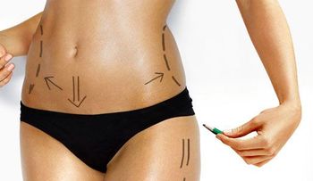 Estudio revela consecuencias  de la liposucción