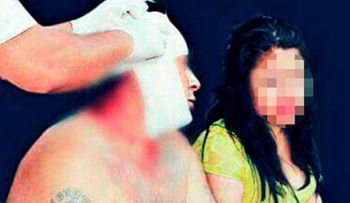 Esposa le da un fuerte botellazo a su pareja durante un trío porque sólo atendía a la otra mujer 