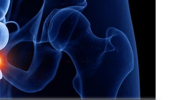 Avance contra cáncer de próstata