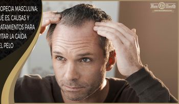 Tipos, Causas y Tratamientos para Evitar la Caída del Pelo