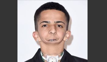 Joven sin mandíbula que escribe rap es nominado en premios para inspirar