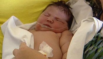 Nace bebe de 13 libras en España con parto natural