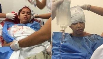 Su pareja le cortó el cuero cabelludo porque se negó a tener sexo