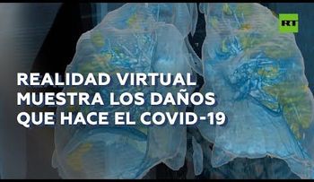 Los daños del coronavirus en unos pulmones sanos. (Video)
