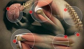 ¿Por qué se le llama Guillain Barré enfermedad que tiene en alerta a varios países?
