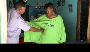 La asombrosa transformación del "niño más obeso del mundo"