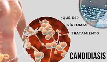 Aceites de coco y de orégano acaban los hongos vaginales