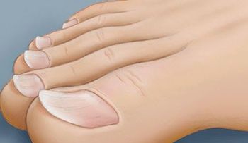 8 advertencias que tus uñas pueden estarte enviando 