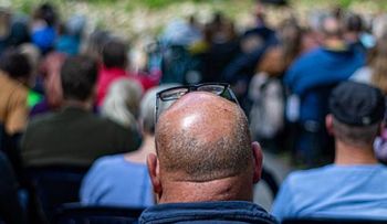 Descubren la clave para la curación definitiva de la calvicie; científicos de EEUU